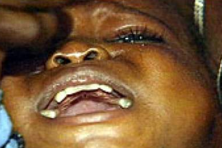 Női csonkítás – Az embertelen tradíció